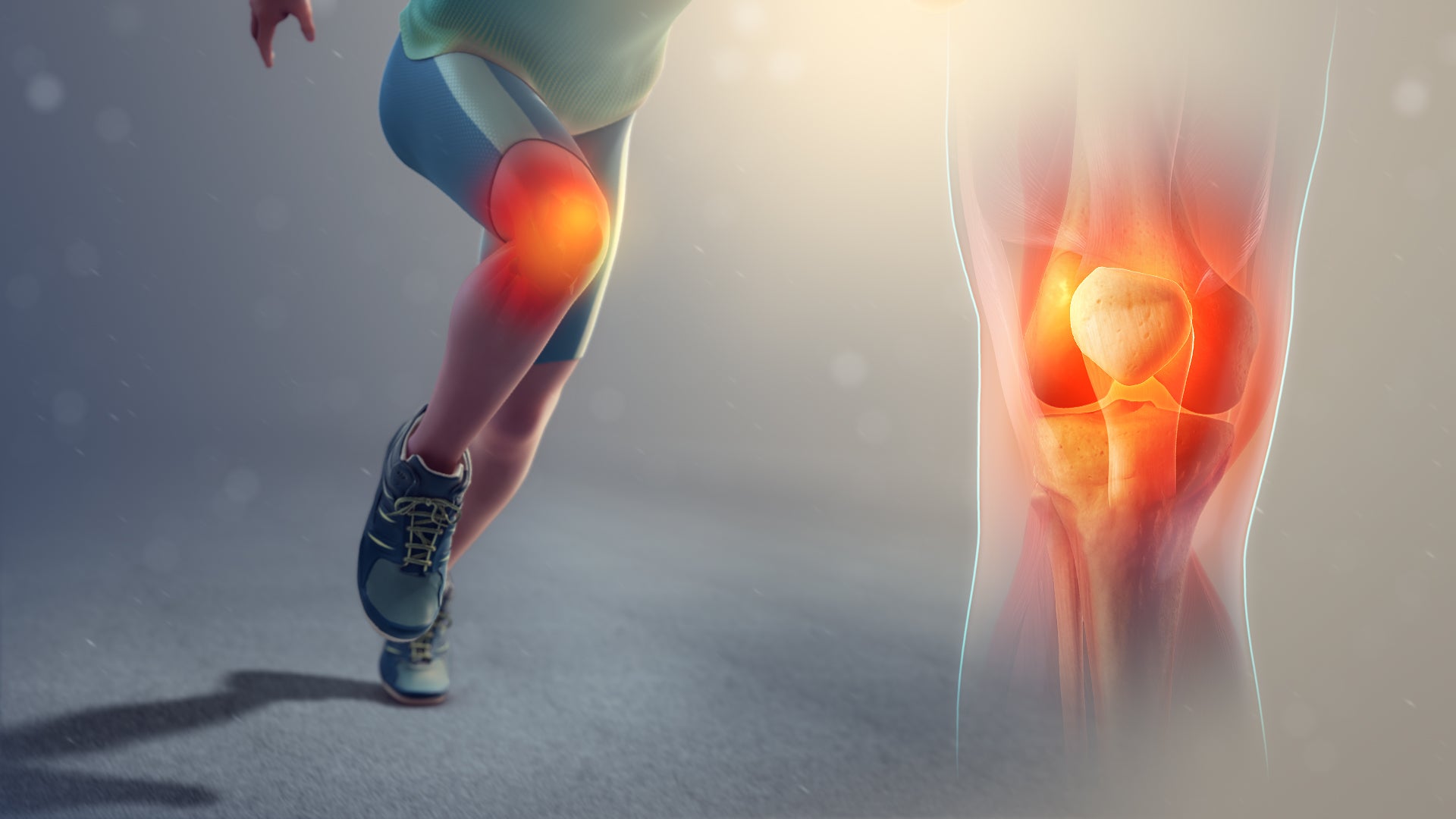 3 Things You Must Know About Runner’s Knee